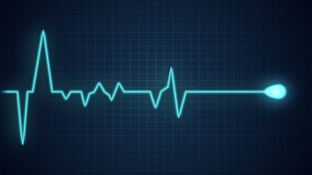 Graphic of a pulse 